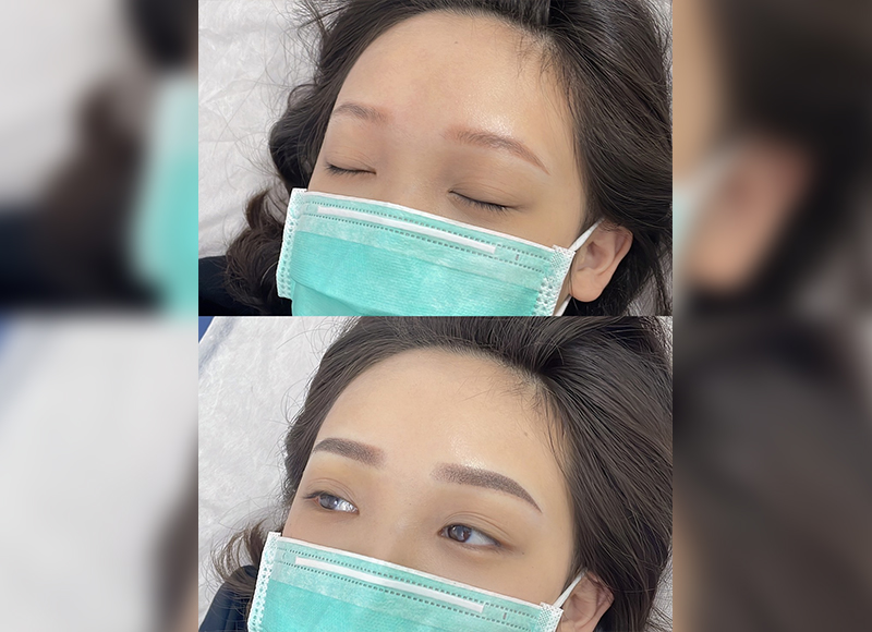 舊眉重整