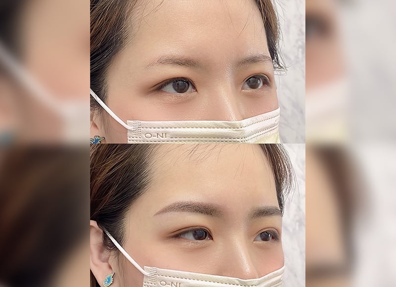 舊眉重整