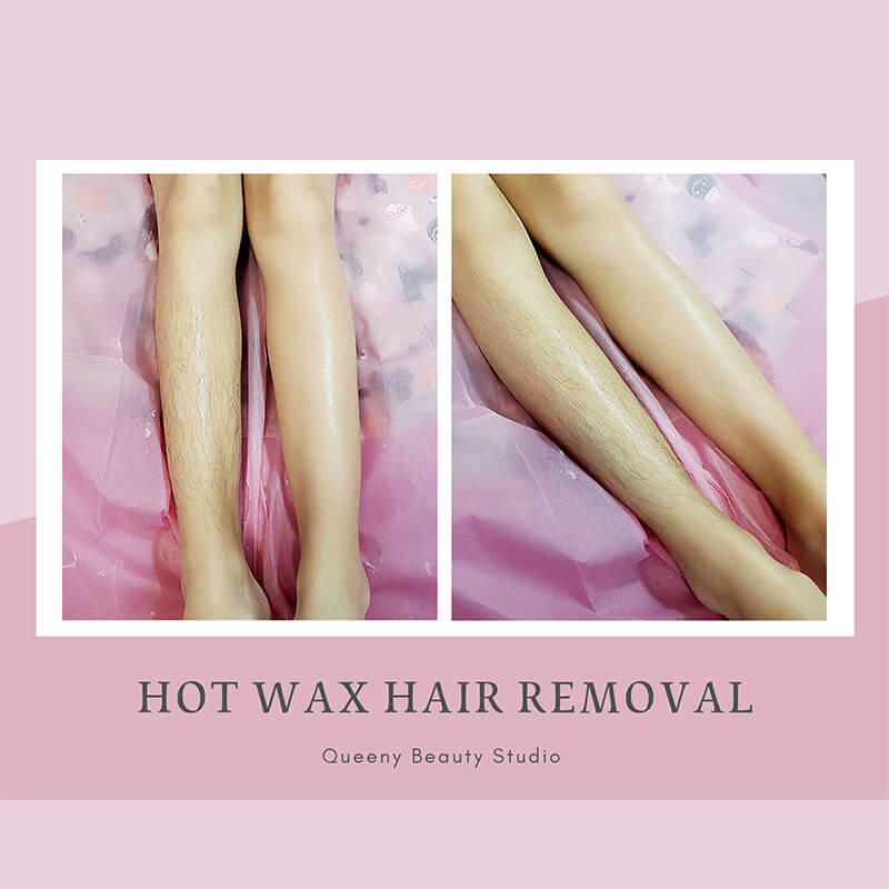 熱蠟除毛